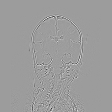 Figure 31