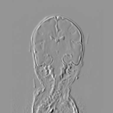 Figure 33