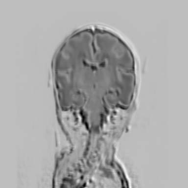 Figure 35