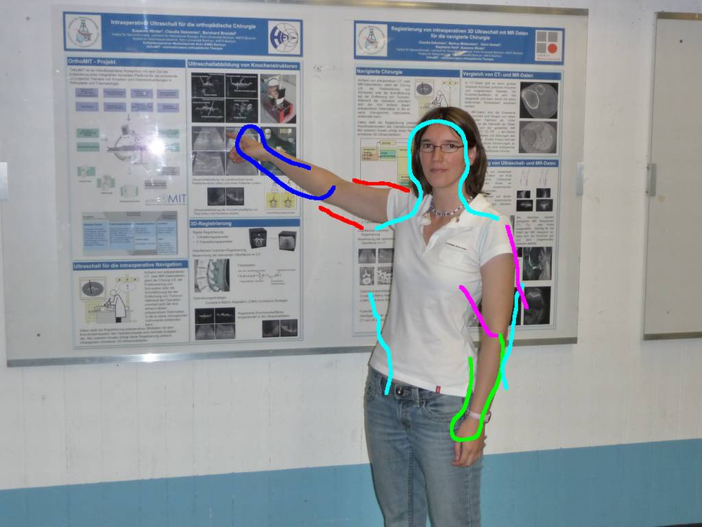 Figure 22
