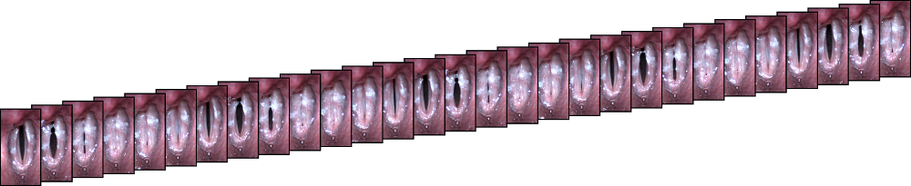 Figure 23