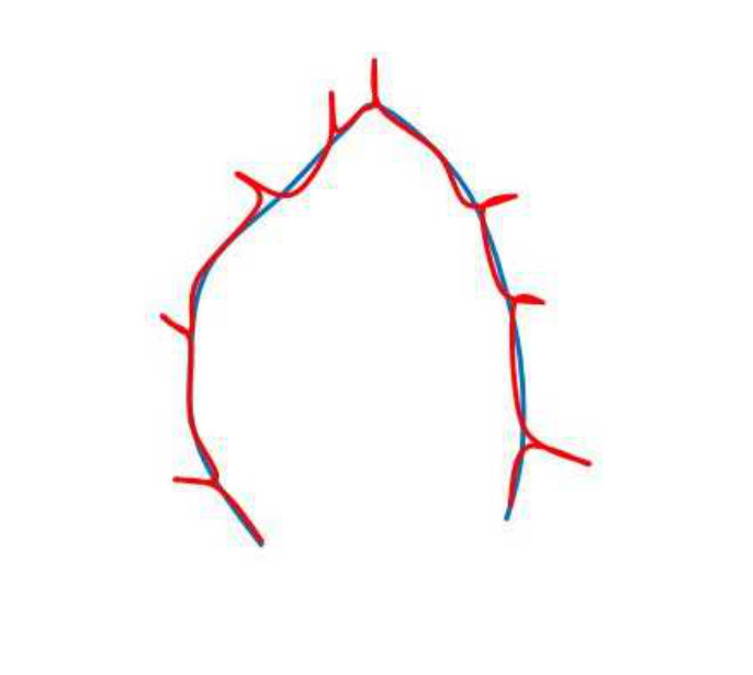 Figure 22