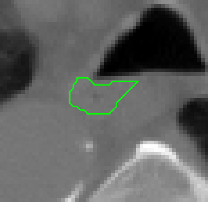 Figure 12