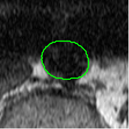 Figure 13
