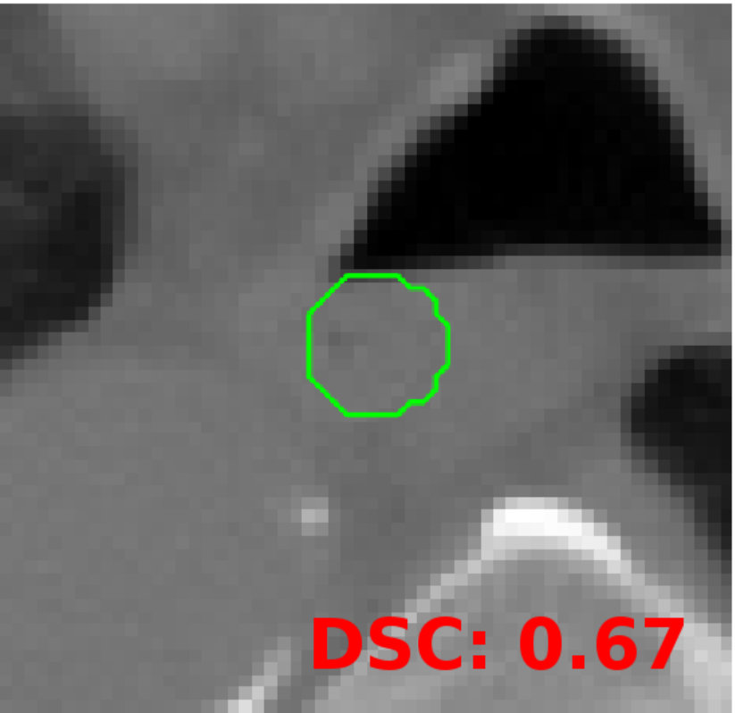 Figure 14