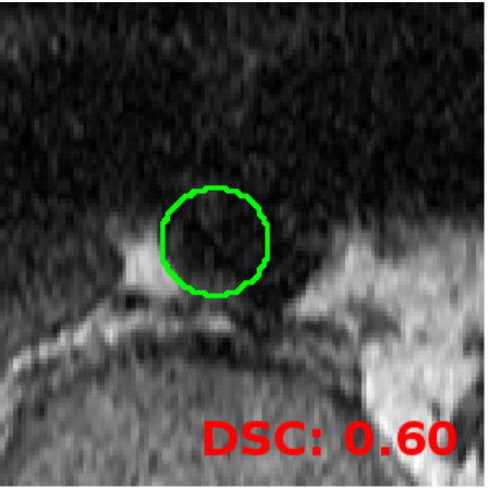 Figure 15