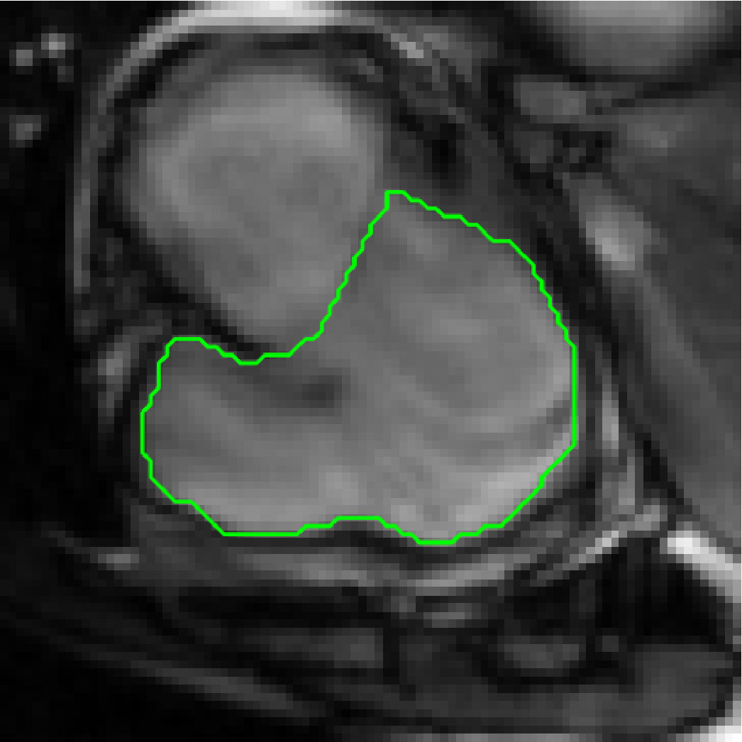 Figure 17