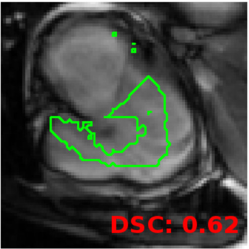 Figure 18