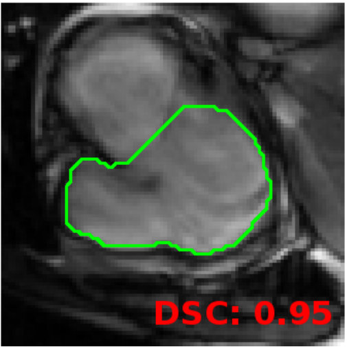 Figure 19