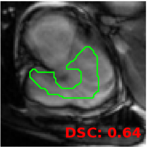 Figure 20