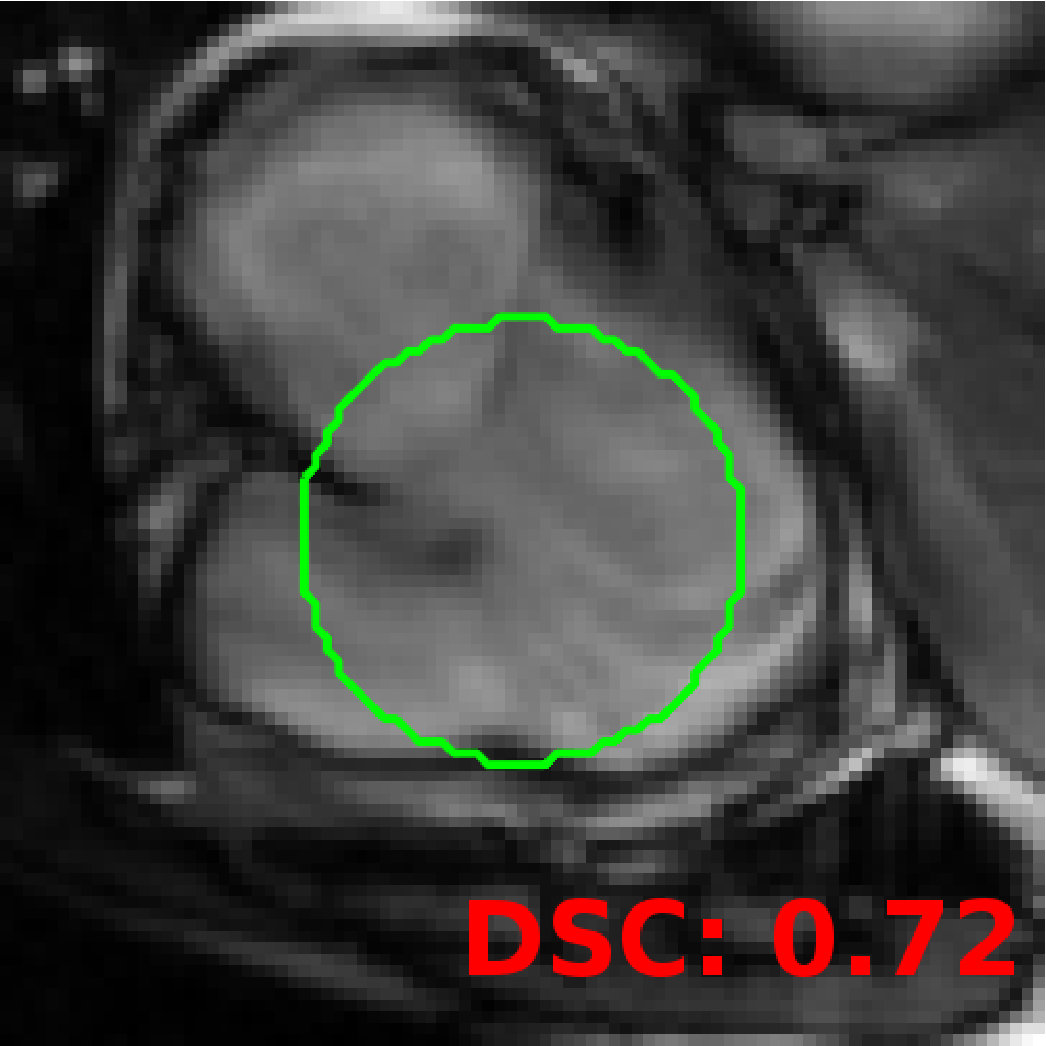 Figure 21
