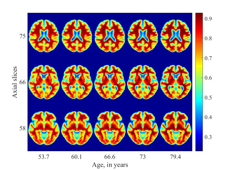 Figure 21