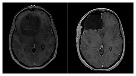 Figure 26