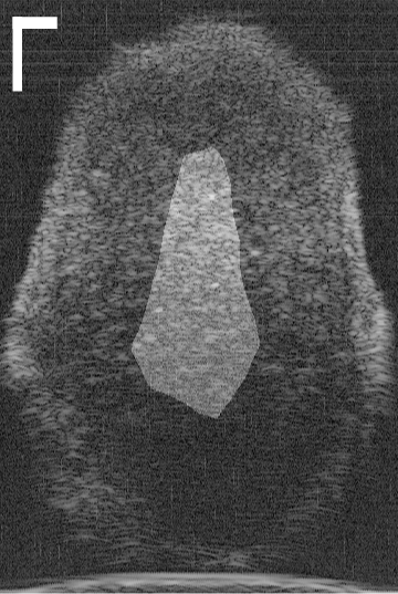 Figure 22