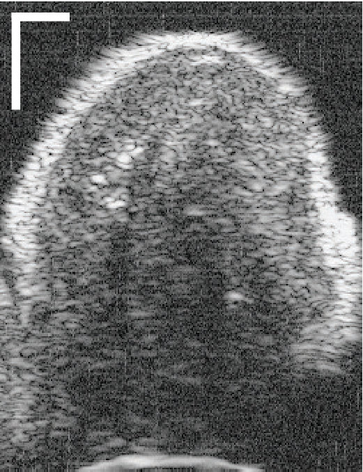 Figure 39