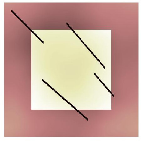 Figure 22