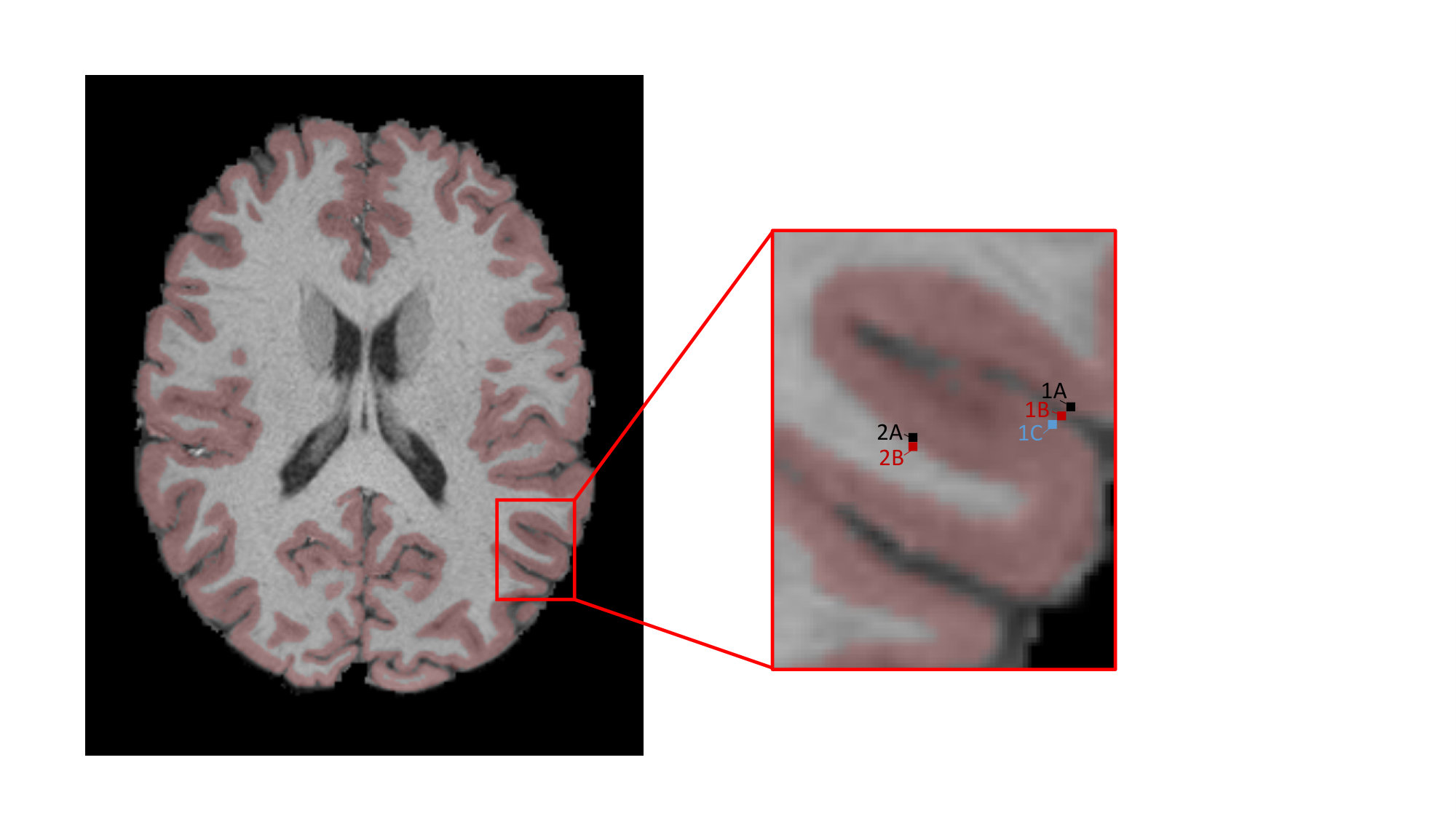 Figure 30