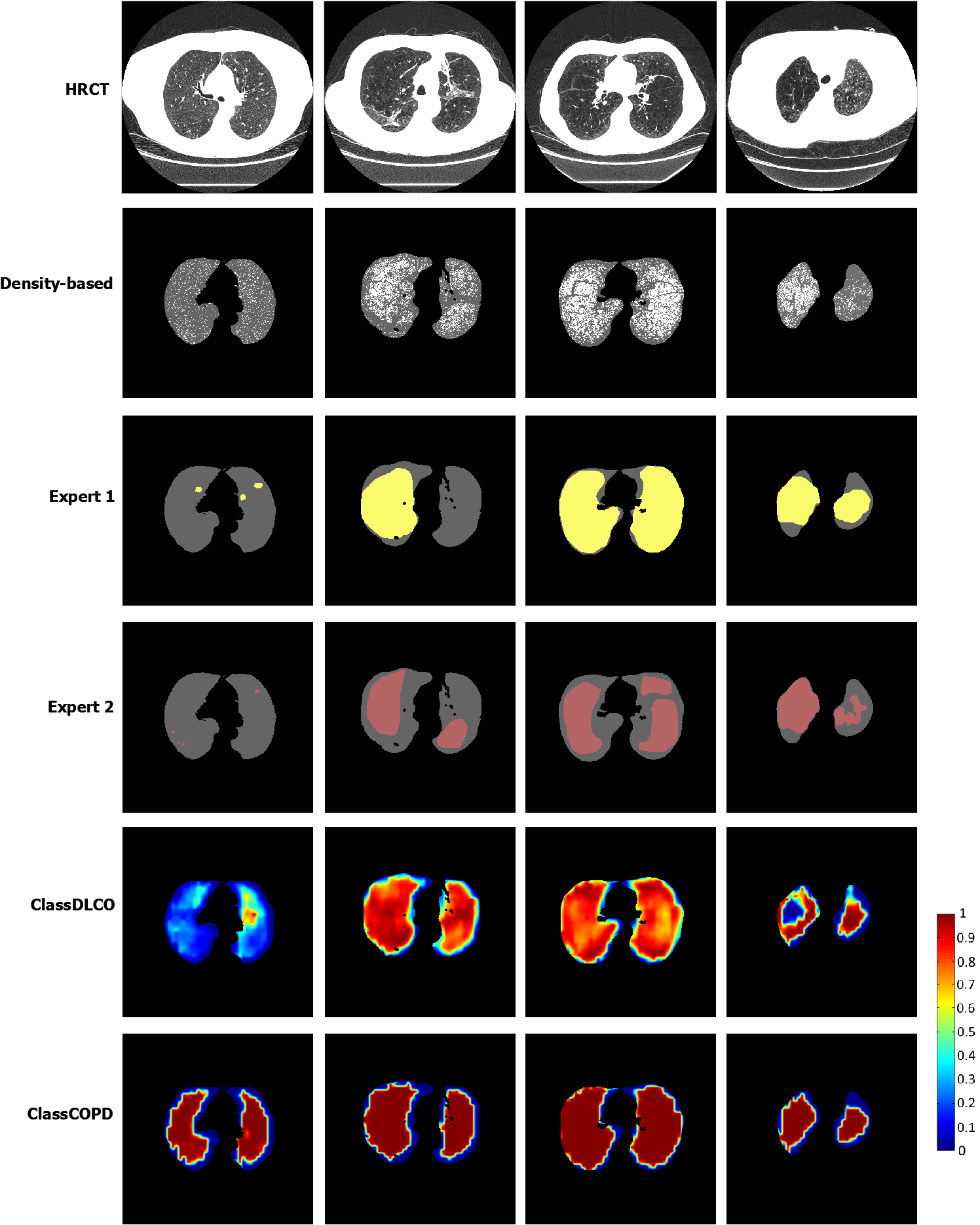 Figure 21
