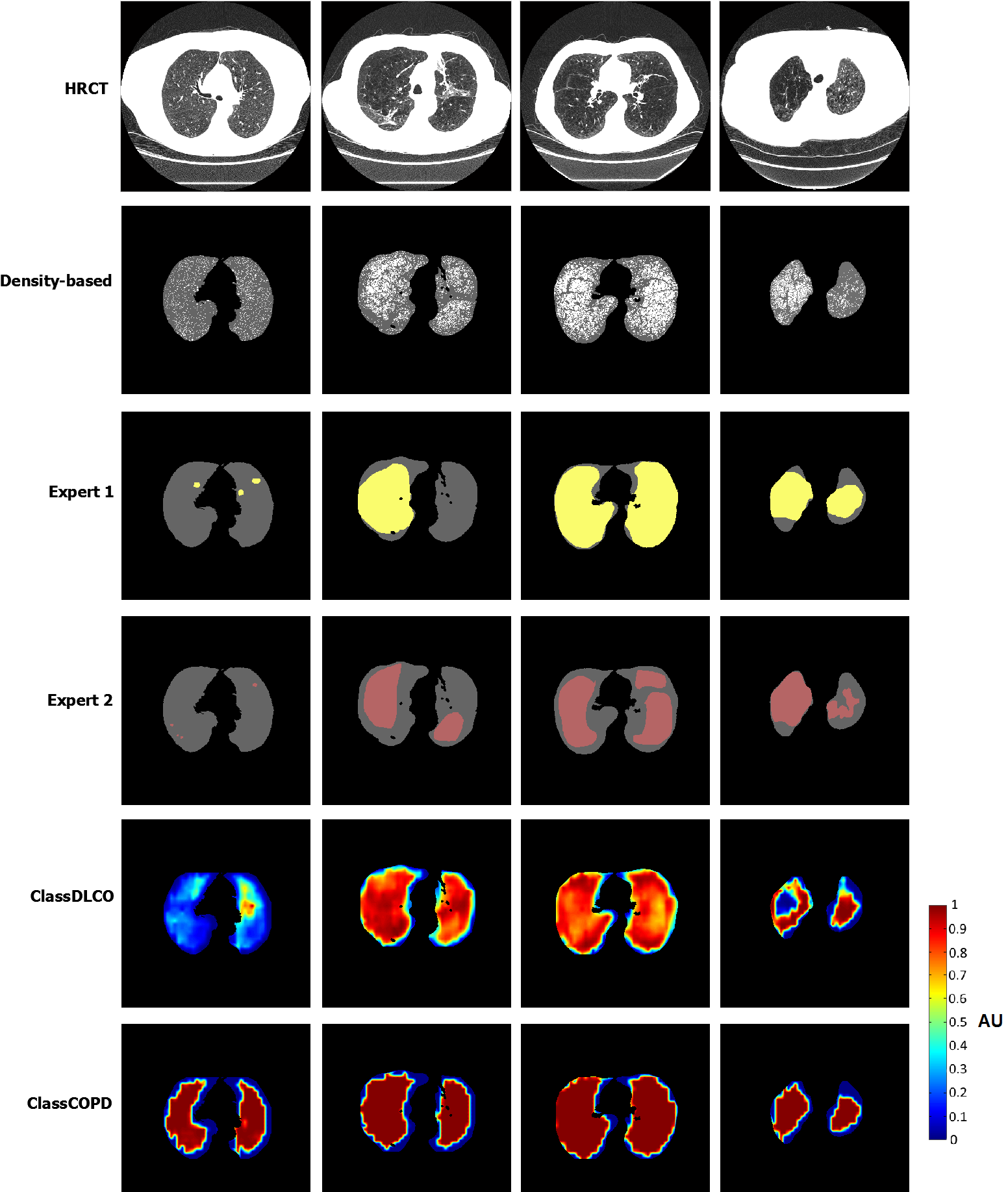 Figure 22