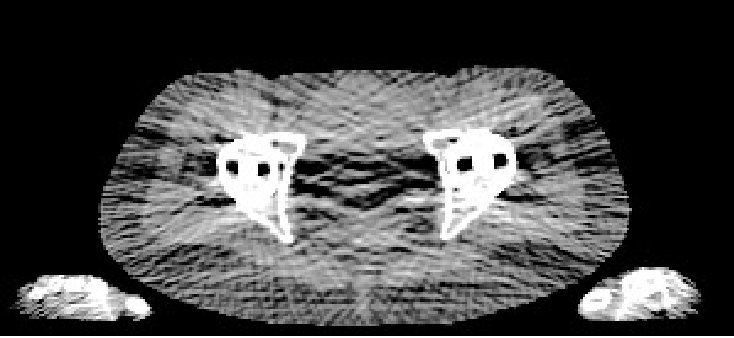 Figure 17