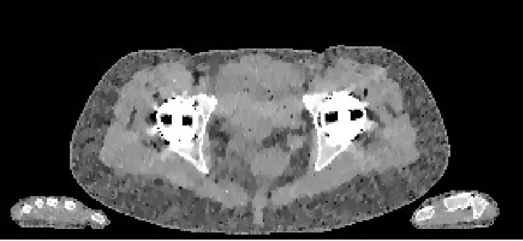 Figure 19