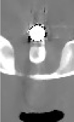 Figure 20
