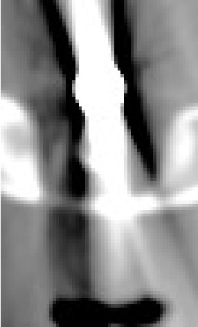Figure 22