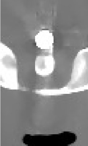 Figure 23