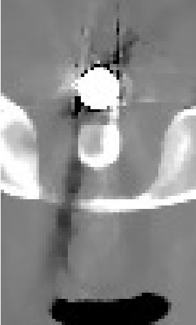 Figure 24