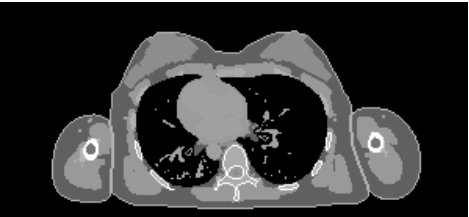 Figure 26