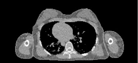 Figure 31