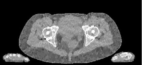 Figure 32