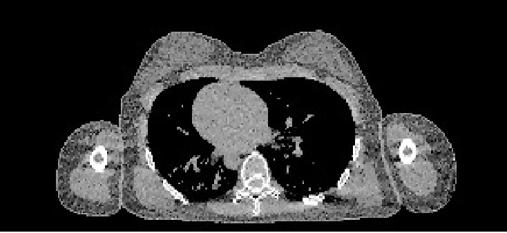 Figure 37