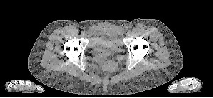 Figure 38