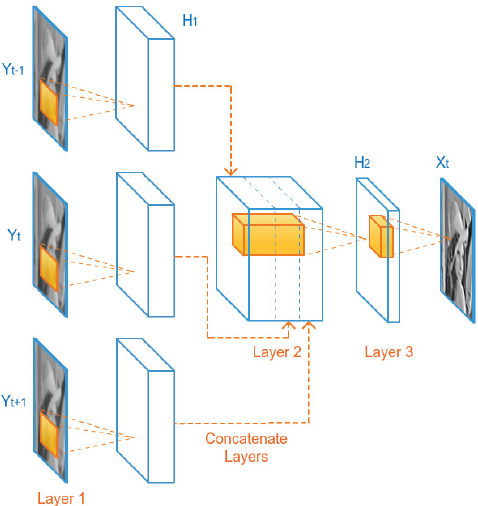 Figure 31