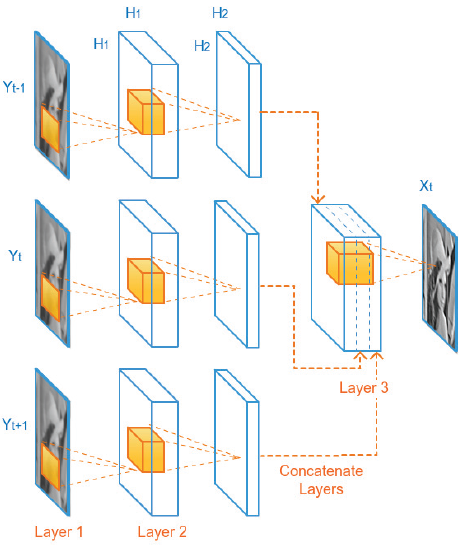 Figure 32