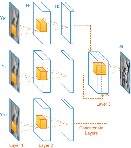 Figure 33