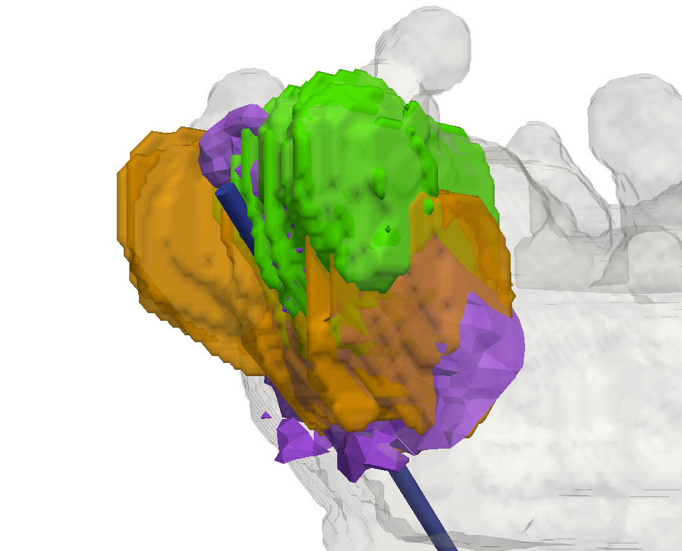 Figure 12