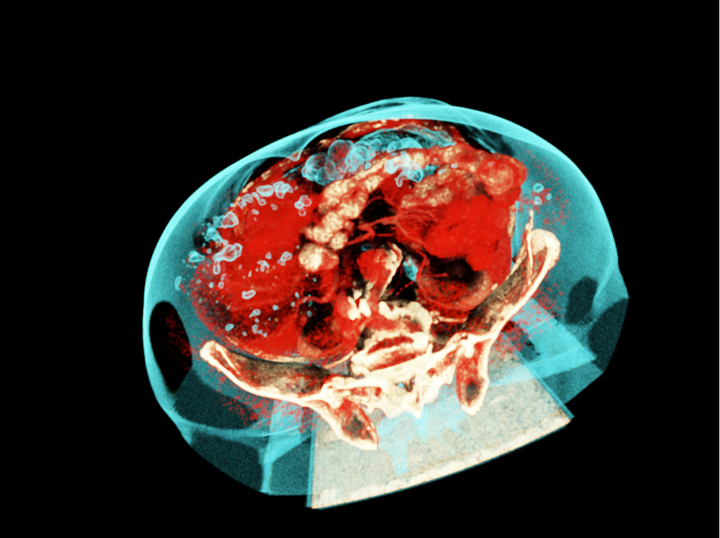 Figure 15