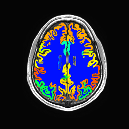 Figure 12