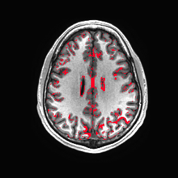 Figure 15
