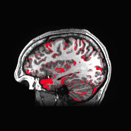 Figure 17