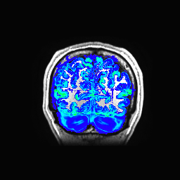 Figure 19