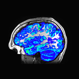Figure 20
