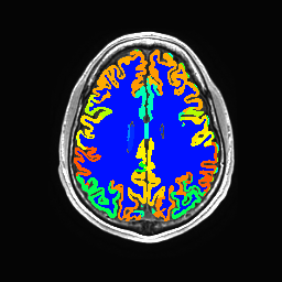 Figure 21