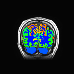 Figure 22