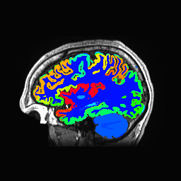Figure 23