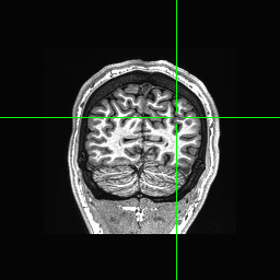 Figure 25