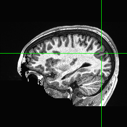 Figure 26