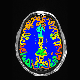 Figure 27